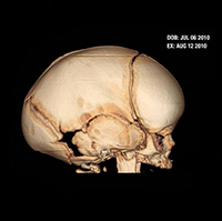 skull image right side