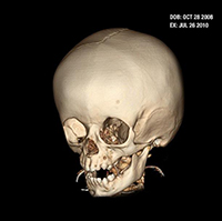 skull image front